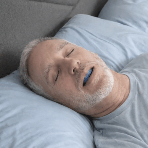 Snorelio Anti-Snoring Mouthpiece (Buy 1 Get 1 Free)